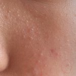 <b>요철</b>없애는법 ㅈㅂㅈㅂ