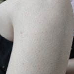 이게 내 피부인데