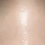 다크<b>써클</b> 심한거임?