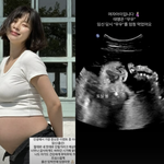 7월 출산 예정, <b>최윤</b>라 “여자 아이, 태명은 ‘무무’”