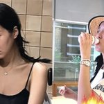 '쌍둥이 임신' 김지혜, <b>낙상</b>사고 후 멘붕…"수치 이상→재검 확정"...