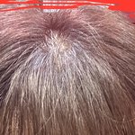 미용실에서 <b>뿌리</b>염색 잘못해서 망했는데 조언 부탁드려요