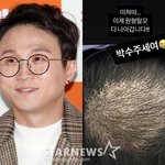 '이솔이' 박성광, 심각한 원형탈모→기적적 극복 "미쳤다..박수주세요"