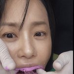 '54세' 고현정도 치과는 무서워..인형 꼭 쥐고 "ㅜㅜ"