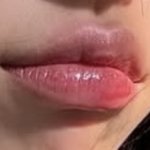[댓글부탁해] 이거 <b>입술</b>필러 맞은 거 같아?