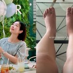 '쌍둥이 만삭' 레이디<b>제인</b> "다리가 이렇게 붓는다고?" 모습...