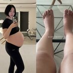 '쌍둥이 임신' 레이디 <b>제인</b>, 출산 앞두고 다리 부기 심각 "이...