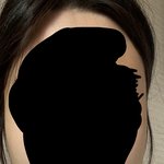 얼굴형 <b>개노답</b> 꼭 윤곽수술해야지