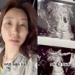 ‘이특 누나’ 박인영, 안타까운 <b>유산</b> 소식 “말하면서도 울컥해....