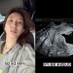 누나' 박인영 <b>유산</b> 고백 "울컥하지만 힘내려고요" 먹먹[스타이슈]