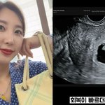 '이특 누나' <b>박인영</b>, 아기 잃었다…"지금도 울컥할 때 있어"...
