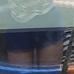 [방탈죄송] 다리 <b>붓기</b> 이 정도로 차이나는 사람 어떰 다이어트 전후...