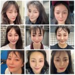 안혜경, 줄기<b>세포</b> 맞은 지 한 달.."변화 확실히 보여"