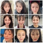 안혜경, 줄기세포 시술 한달만 <b>비포</b>애프터 공개 “변화 확실히 보여”