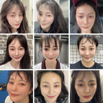 안혜경도 했네..줄기<b>세포</b> 시술 기적의 후기 "안면홍조 사라져"