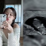 <b>AOA</b> 유나, 결혼 1년 반 만에 '임신' 소식…"예쁜 아이 찾아왔다"...