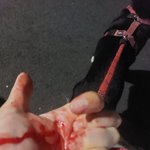 [이것좀봐줘] 반복되는 개물림 사고(사진주의)