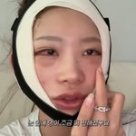 '故최진실 딸' 최준희, 윤곽+눈 <b>성형후</b> 퉁퉁부은 얼굴.."앞이...