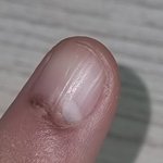 [도와주세요] <b>손톱</b>에 갈색