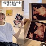 '쌍둥이 임신' 김지혜, 입체초음파 안타까운 소식 "미안해 아빠가...
