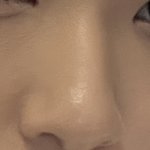 너네가 이코면 <b>수술</b>함?