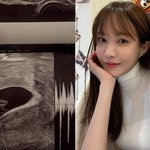 '임신' 서민재 "아이 친부, 여전히 연락 없어…책임·<b>도리</b> 외면