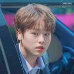 [드루와] 입술입꼬리필러 맞고싶은데 고민됨