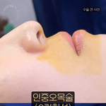요즘 이런 성형도 <b>유행</b>하나?