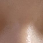 5년전 <b>쌍수</b> 심각하게 망함