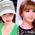 <b>박봄</b>, 턱 보정했나 안 했나? 사진 올리자마자 '관심 집중'