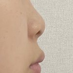 나 코<b>수술</b>했는데 질문받