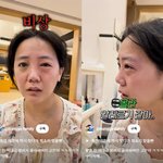 고은아, <b>낙상</b>사고 이어 또 안타까운 소식…역대급 알러지에 '눈 퉁퉁'