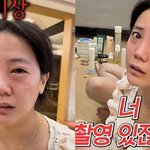 [댓글부탁해] 고은아, 코수술→<b>낙상</b>사고 이어 '퉁퉁부은 눈'..촬영...