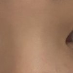 <b>짝눈</b> 심함??