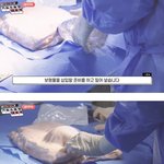 가슴수술 아이러니한점