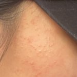 애<b>드랑</b> 제발 내 피부 조언 좀 ㅠㅠ