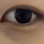 나 눈 뒤 쪽 좀 <b>파인</b> 편이야?