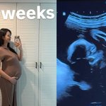 ‘송재희’ 지소연, 쌍둥이 초음파 공개…부모 우월 비주얼 똑닮았네