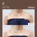 요즘 핫하다는 <b>어깨필러</b>