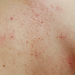 아 등<b>드름</b> 때문에 돌아버리겠네