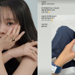 '박성광' 이솔이 "혈관 거의 녹아"…항암 치료 후 <b>채혈</b>에 '긴장'