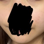 (혐)나 피부과 <b>가야</b>됨?