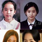 우리나라 <b>성형</b>왕국된 이유는 연예인때문도 있음