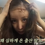 '애둘맘' <b>윤진</b>이, 휑한 이마 '충격'…"머리 미친 듯이 빠져...