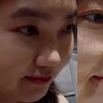 [코크림] 성형없이 코<b>라인</b> 살리기?