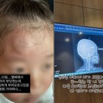 김보미, 아들 머리 부상에 병원行…"엄마가 미안하다"