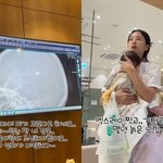 '윤전일' <b>김보미</b>, 아들 이마 피 고여 병원行.."엄마가 미안해"