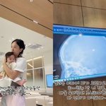 '윤전일' <b>김보미</b>, 子 이마 부상에 긴급 병원行 "한눈 판 내...