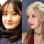 <b>벨</b> 성형 ㄹㅈㄷ