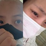 '걸그룹 굿<b>데이</b>' 류지원, 백혈병 투병 고백.."3차 치료 머리...